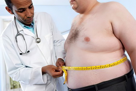 Лечение ожирения у мужчин