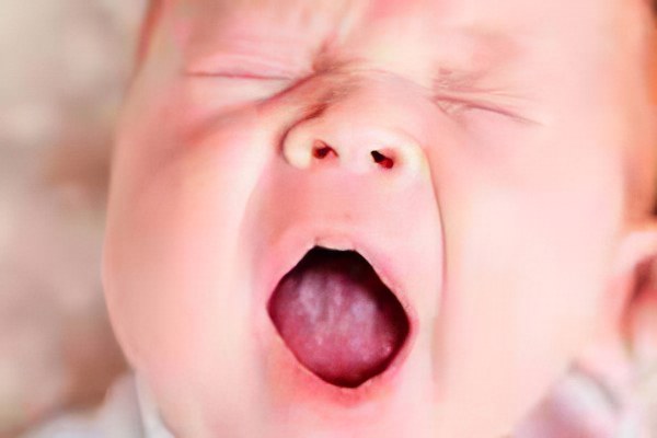 Как вылечить новорожденного от молочницы зеленкой thumbnail