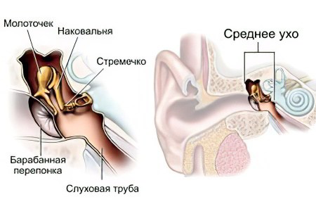 Воспаление среднего уха симптомы фото thumbnail