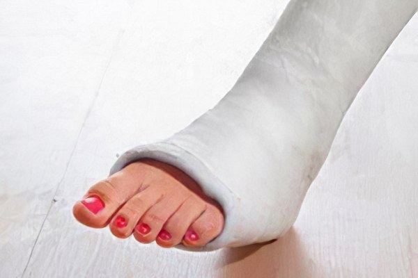Чем лечить последствия перелома ноги thumbnail