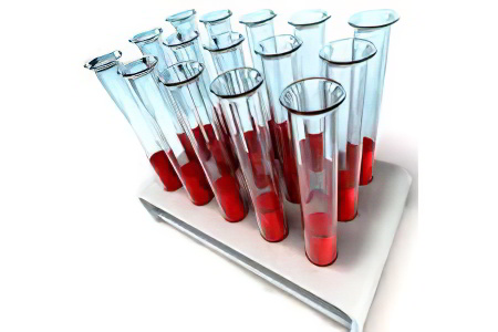 Биохимический анализ крови расшифровка что такое алт thumbnail
