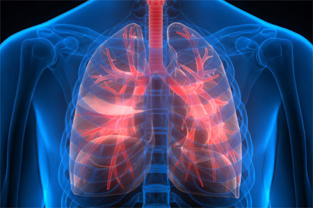 Отличие пневмонии от других лёгочных заболеваний